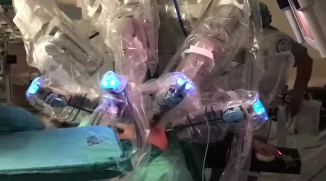 Equipo quirúrgico y sistema robótico durante una operación real